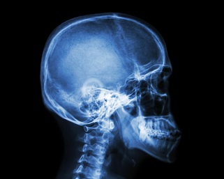 Anatomy and Pathophysiology Series; Brain Injuries Webinar