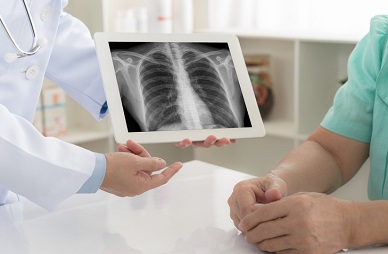 Bronchoscopy Billing - Navigational and EBUS Webinar