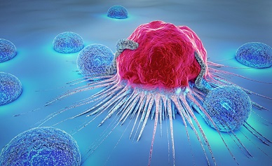 Navigating Neoplasm Coding Webinar
